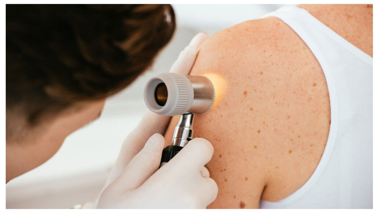 Dermatology