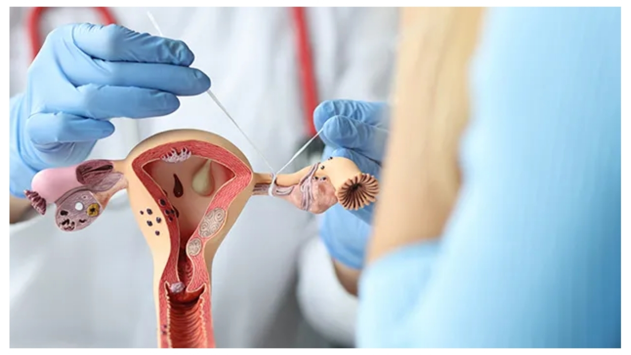 Gynecology