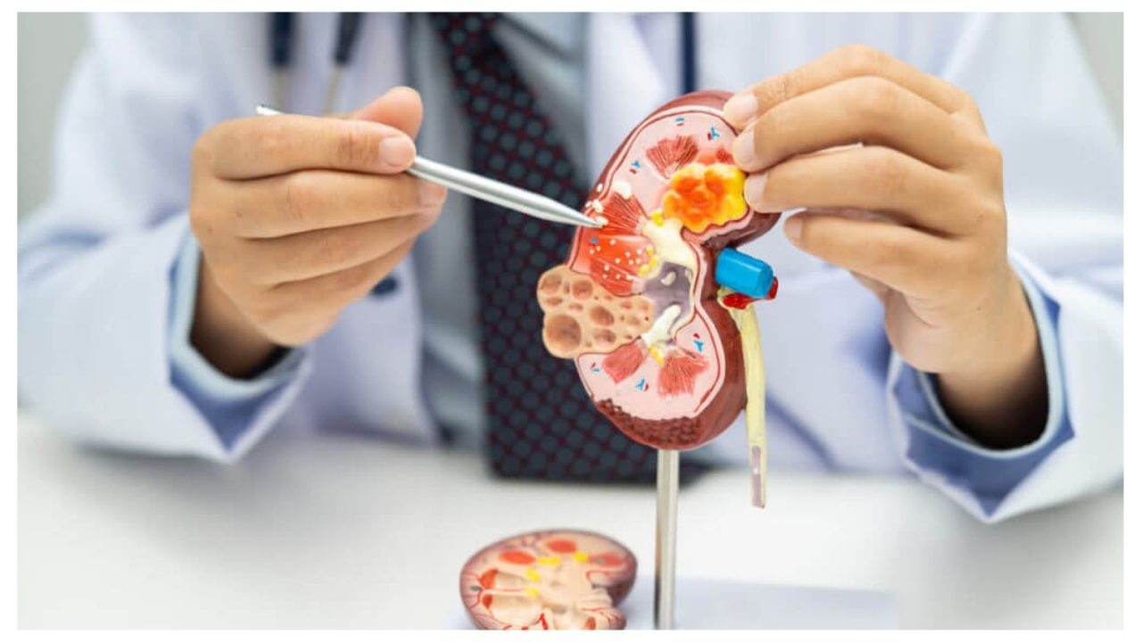 Nephrology